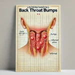 Back Throat Bumps